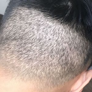 发际线分享社区