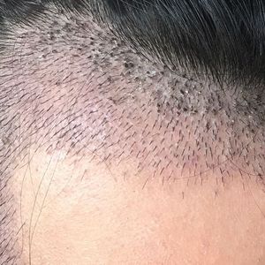 发际线分享社区