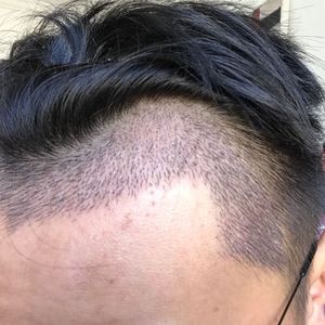发际线分享社区