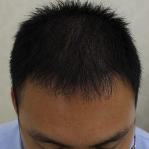 发际线分享社区