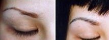 眉毛种植效果如何？种眉毛有没有副作用？
