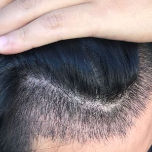 发际线分享社区