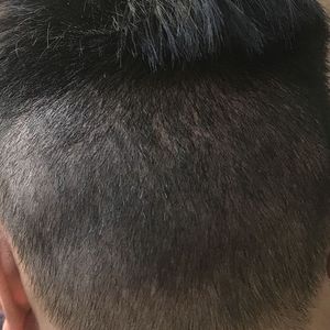 发际线分享社区