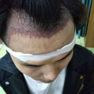 发际线分享社区