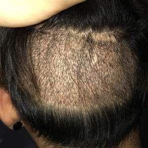 发际线分享社区