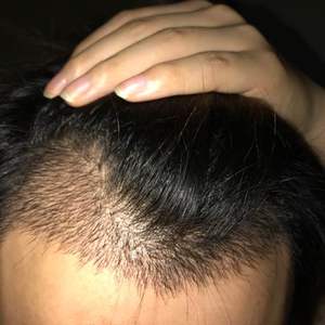 发际线分享社区