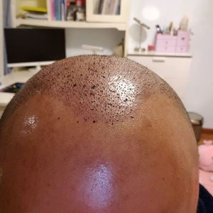 发际线分享社区