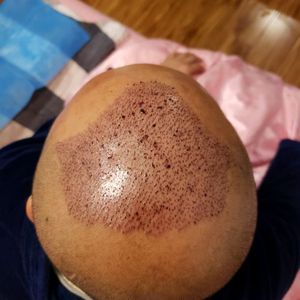 发际线分享社区