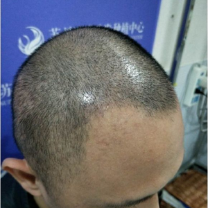 发际线分享社区
