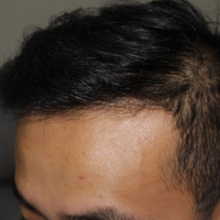 <font color="red">稀少加密</font>用戶圖片