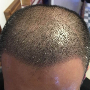 发际线分享社区