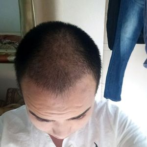 发际线分享社区