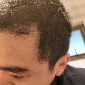 发际线分享社区