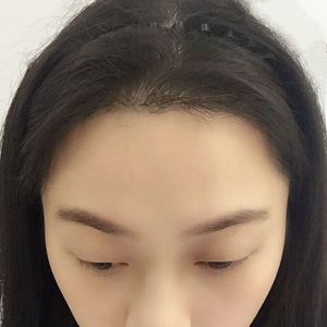 发际线分享社区