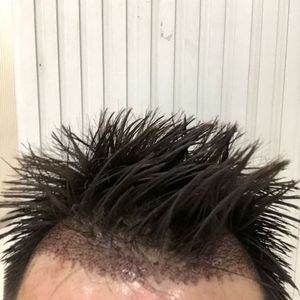 发际线分享社区
