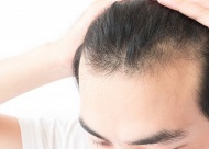 头发种植效果怎么样?头发种植能维持多久?