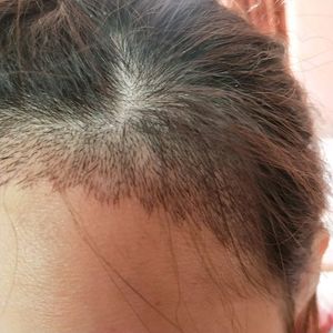 发际线分享社区