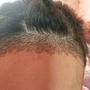 发际线分享社区