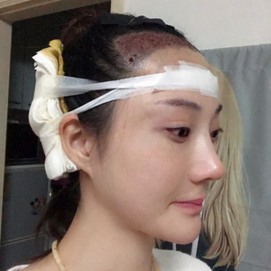 发际线分享社区