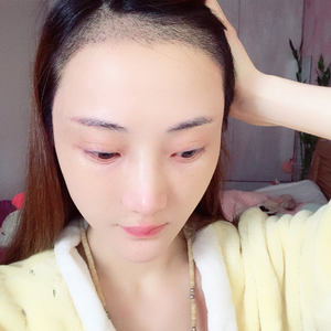 发际线分享社区