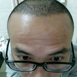 发际线分享社区