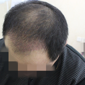 发际线分享社区