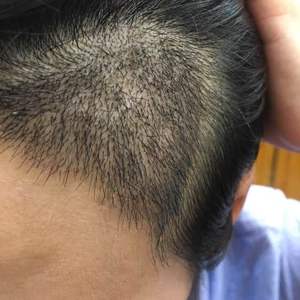 发际线分享社区