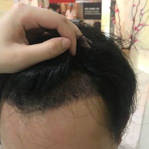 发际线分享社区