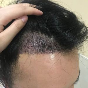 发际线分享社区