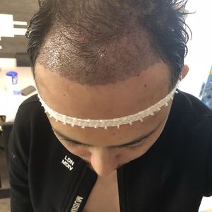 发际线分享社区