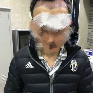 发际线分享社区