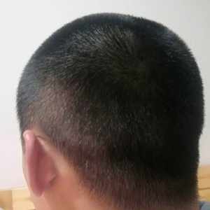发际线分享社区