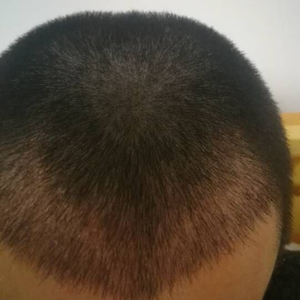 发际线分享社区