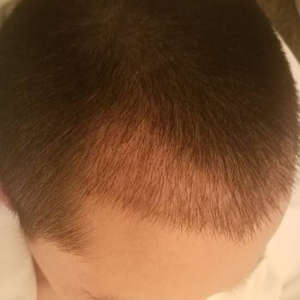 发际线分享社区