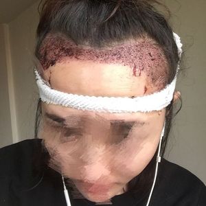 发际线分享社区