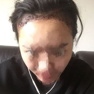 发际线分享社区