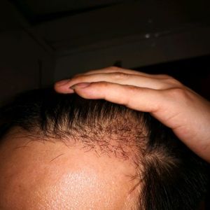 发际线分享社区