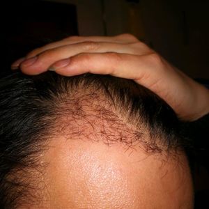 发际线分享社区