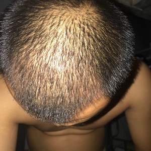 发际线分享社区
