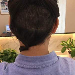 发际线分享社区
