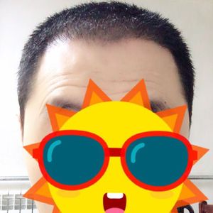 发际线分享社区