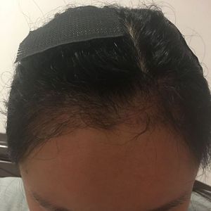 发际线分享社区