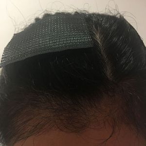 发际线分享社区