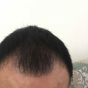 发际线分享社区