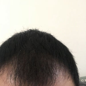 发际线分享社区