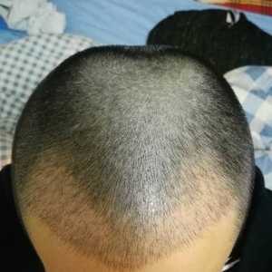 发际线分享社区