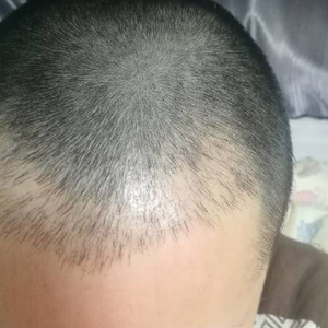 发际线分享社区