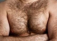 胸毛种植的优点有哪些 胸毛种植手术注意事项