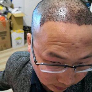 发际线分享社区