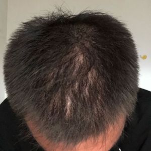 发际线分享社区